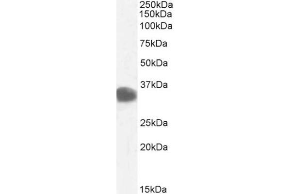 CBR1 antibody  (C-Term)