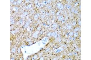 Immunohistochemistry of paraffin-embedded Rat brain using PTGDS Polyclonal Antibody at dilution of 1:200 (40x lens). (PTGDS antibody)