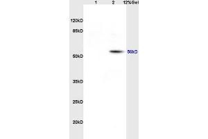 Lane 1: rat heart lysates Lane 2: rat brain lysates probed with Anti EAAT1/Glast Polyclonal Antibody, Unconjugated (ABIN730783) at 1:200 in 4 °C. (SLC1A3 antibody  (AA 301-400))