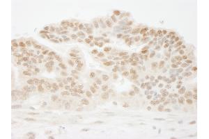 anti-Cleavage Stimulation Factor, 3' Pre-RNA, Subunit 1, 50kDa (CSTF1) (AA 75-125) antibody