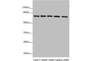 Western blot All lanes: SDHA antibody at 10 μg/mL Lane 1: Rat heart tissue Lane 2: Mouse spleen tissue Lane 3: Mouse liver tissue Lane 4: Hela whole cell lysate Lane 5: Zebrafish lysate Secondary Goat polyclonal to rabbit IgG at 1/10000 dilution Predicted band size: 73, 68, 57 kDa Observed band size: 73 kDa (SDHA antibody  (AA 44-664))