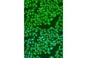 Immunofluorescence analysis of U2OS cells using ITGA2 antibody. (ITGA2 antibody)