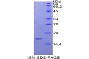 SDS-PAGE analysis of Rat GP1Bb Protein. (Glycoprotein Ib (Platelet), beta Polypeptide (GP1BB) Peptide)