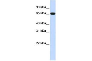 WB Suggested Anti-ZNF775 Antibody Titration: 0.