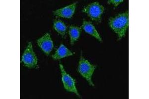 Confocal immunofluorescent analysis with 293 cells using LCAT  Antibody , followed by Alexa Fluor® 488-conjugated goat anti-rabbit lgG (green). (LCAT antibody  (Middle Region))