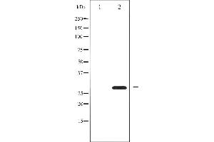 Western blot analysis of BCL-2 phosphorylation expression in nocodazole treated HeLa whole cell lysates,The lane on the left is treated with the antigen-specific peptide. (Bcl-2 antibody  (pSer87))