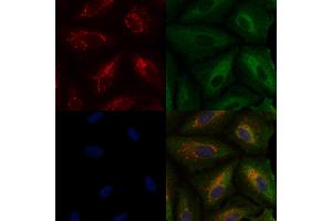 ABIN6259707 and ABIN6276744 staining  cells by IF/ICC.