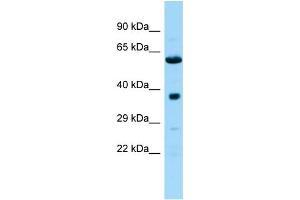 Host: Rabbit Target Name: Ndufa10l1 Sample Type: Rat Pancreas lysates Antibody Dilution: 1. (NDUFA10L1 antibody  (C-Term))