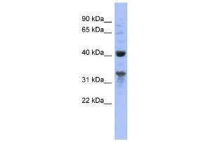 WB Suggested Anti-MRPL37 Antibody Titration: 0. (MRPL37 antibody  (N-Term))