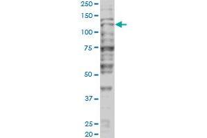 Western Blotting (WB) image for anti-Tripartite Motif Containing 24 (TRIM24) (AA 432-569) antibody (ABIN599067) (TRIM24 antibody  (AA 432-569))