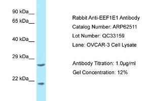 Western Blotting (WB) image for anti-Eukaryotic Translation Elongation Factor 1 epsilon 1 (EEF1E1) (N-Term) antibody (ABIN2789165)