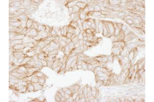 Immunohistochemistry (IHC) image for anti-Adducin 1 (Alpha) (ADD1) (AA 632-682) antibody (ABIN7454952) (alpha Adducin antibody  (AA 632-682))