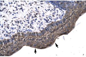 Human Spermatophore (KIN antibody  (Middle Region))