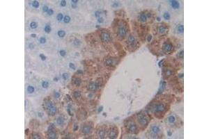 Used in DAB staining on fromalin fixed paraffin- embedded Kidney tissue (CRYBA1 antibody  (AA 1-215))