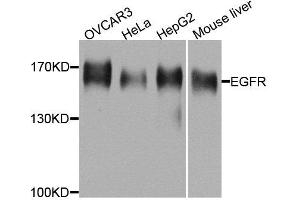 Western blot analysis of extracts of various cell lines, using EGFR antibody. (EGFR antibody  (AA 1021-1210))