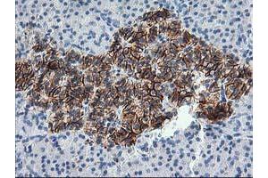 Immunohistochemical staining of paraffin-embedded Human pancreas tissue using anti-SNAP25 mouse monoclonal antibody. (SNAP25 antibody)