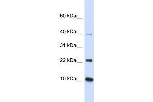 WB Suggested Anti-UBE2D2 Antibody Titration:  0. (UBE2D2 antibody  (N-Term))