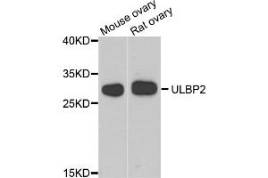 Western blot analysis of extracts of various cell lines, using ULBP2 antibody (ABIN5974540) at 1/1000 dilution.