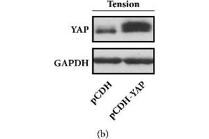 Forced overexpression of YAP promotes the osteogenic differentiation of HPDLCs. (YAP1 antibody)