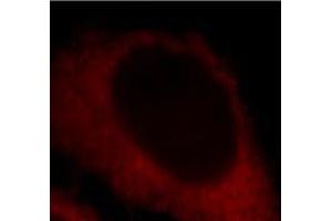 Immunofluorescent analysis of HepG2 cells, using LDHA antibody at 1:25 dilution and Rhodamine labeled goat anti-rabbit IgG (red).