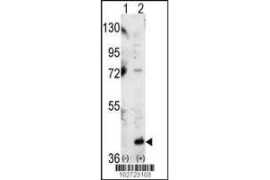 Western blot analysis of P38 using P38 Antibody using 293 cell lysates (2 ug/lane) either nontransfected (Lane 1) or transiently transfected with the MAPK14 gene (Lane 2). (MAPK14 antibody  (C-Term))