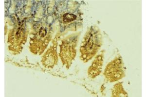 ABIN6279064 at 1/100 staining Mouse colon tissue by IHC-P. (LPGAT1 antibody  (Internal Region))