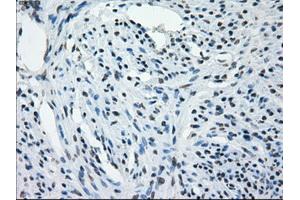 Immunohistochemical staining of paraffin-embedded Kidney tissue using anti-AURKCmouse monoclonal antibody. (Aurora Kinase C antibody)