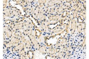 ABIN6257793 and ABIN6276233 at 1/100 staining Rat kidney tissue by IHC-P.