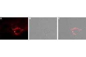 Expression of KV1. (Kv1.4 antibody  (1st Extracellular Loop))