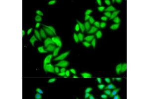 Immunofluorescence analysis of HeLa cells using IKK beta Polyclonal Antibody (IKBKB antibody)