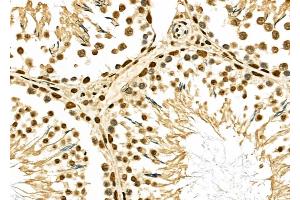 ABIN6264499 and ABIN6276907 at 1/100 staining Rat testis tissue by IHC-P.