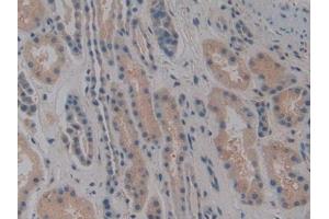 DAB staining on IHC-P; Samples: Human Kidney Tissue (NOSIP antibody  (AA 62-295))