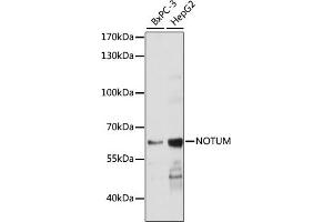 Western blot analysis of extracts of various cell lines, using NOTUM antibody (ABIN7268961) at 1:1000 dilution. (NOTUM antibody  (AA 20-320))