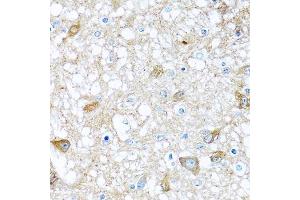 Immunohistochemistry (Paraffin-embedded Sections) (IHC (p)) image for anti-Bone Morphogenetic Protein 5 (BMP5) (AA 317-454) antibody (ABIN6137604)
