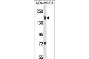 Western blot analysis of ITGA2 Antibody (C-term) (ABIN652993 and ABIN2842630) in MDA-M cell line lysates (35 μg/lane). (ITGA2 antibody  (C-Term))