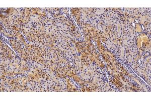 Detection of TF in Porcine Kidney Tissue using Polyclonal Antibody to Transferrin (TF) (Transferrin antibody)