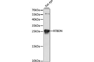 Western blot analysis of extracts of rat eye, using RTBDN antibody. (Retbindin antibody)