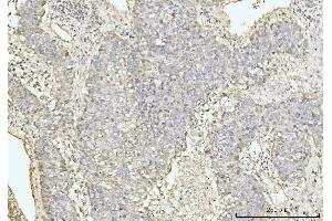 IHC analysis of GRPEL1 using anti-GRPEL1 antibody (ABIN7602643). (GRPEL1 antibody  (AA 90-217))