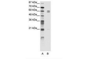Image no. 1 for anti-FEZ Family Zinc Finger 2 (FEZF2) (C-Term) antibody (ABIN203150) (FEZF2 antibody  (C-Term))