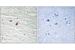 Immunohistochemistry analysis of paraffin-embedded human brain, using C/EBP-epsilon (Phospho-Thr74) Antibody. (CEBPE antibody  (pThr74))