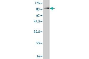 Western Blotting (WB) image for anti-Checkpoint Kinase 2 (CHEK2) (AA 1-543) antibody (ABIN564867)