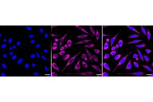 anti-Insulin-Like Growth Factor Binding Protein 7 (IGFBP7) antibody