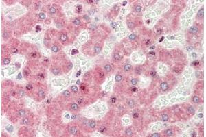Human Liver: Formalin-Fixed, Paraffin-Embedded (FFPE) (ZGPAT antibody  (N-Term))