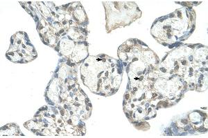 Human Placenta (EPS8-Like 1 antibody  (N-Term))
