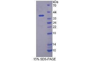 SDS-PAGE analysis of Human TIF1b Protein.