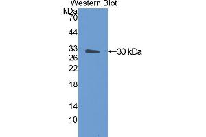 Western Blotting (WB) image for anti-Angiopoietin-Like 4 (ANGPTL4) (AA 182-394) antibody (ABIN1174071) (ANGPTL4 antibody  (AA 182-394))