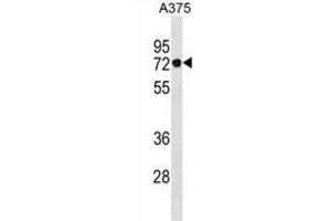 Western Blotting (WB) image for anti-Podocan (PODN) antibody (ABIN3001059)
