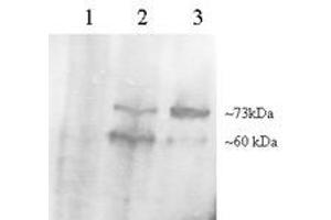 Image no. 1 for anti-Proprotein Convertase Subtilisin/kexin Type 9 (PCSK9) (C-Term) antibody (ABIN374535) (PCSK9 antibody  (C-Term))