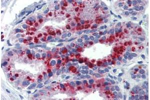 Human Prostate: Formalin-Fixed, Paraffin-Embedded (FFPE) (KCNK9 antibody  (AA 36-85))