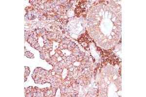 Immunohistochemistry (IHC) image for anti-Marginal Zone B and B1 Cell-Specific Protein (MZB1) (AA 1-189) antibody (ABIN7268403)